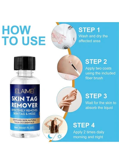 Skin Tag Remover